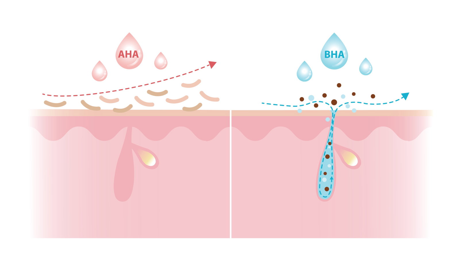 AHA vs BHA Diagram