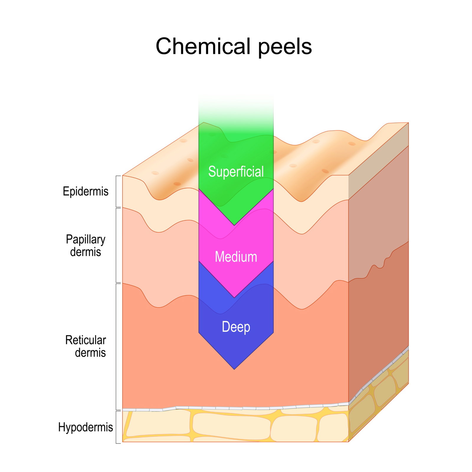 Perfecting Peel