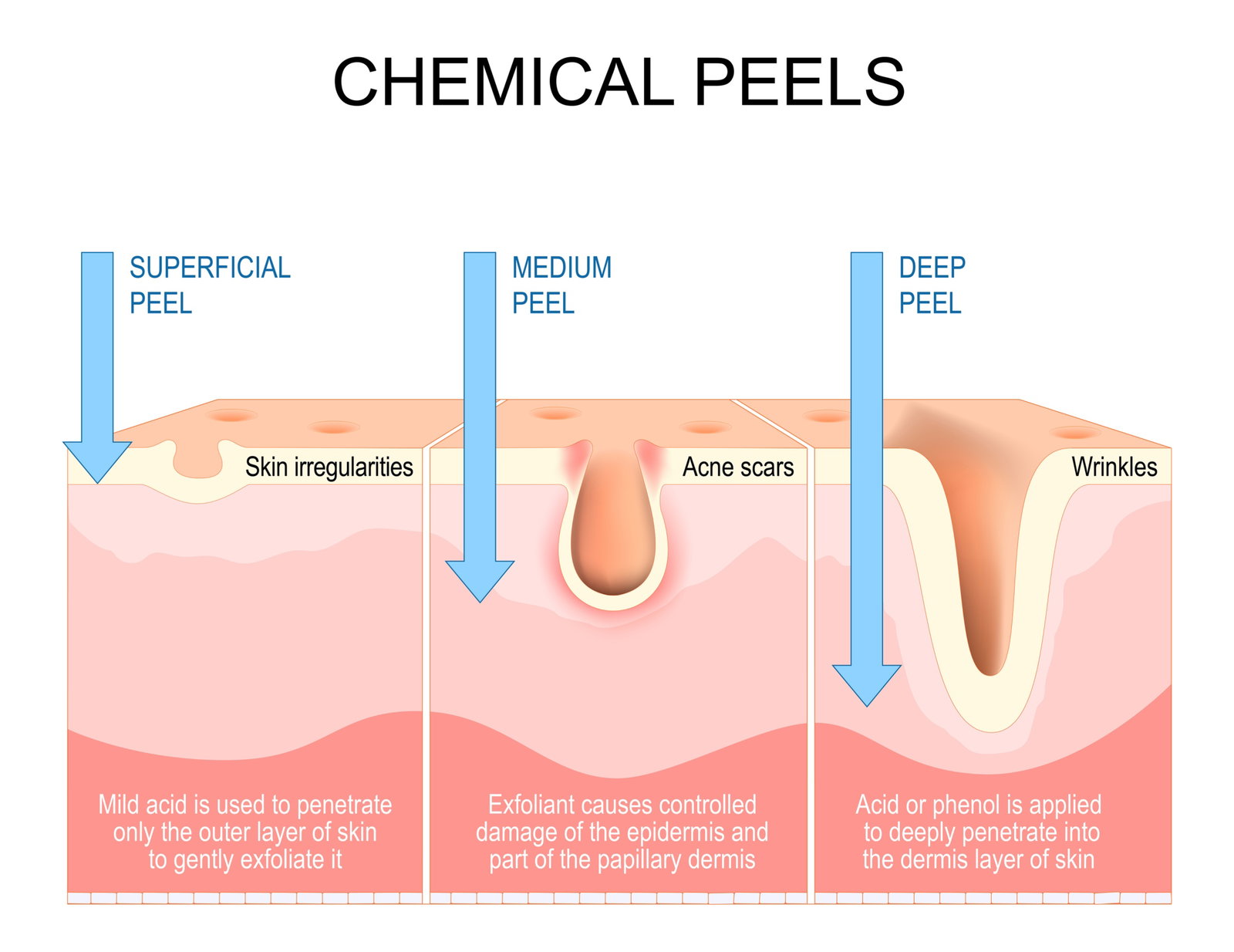 Pigment Correct Peel