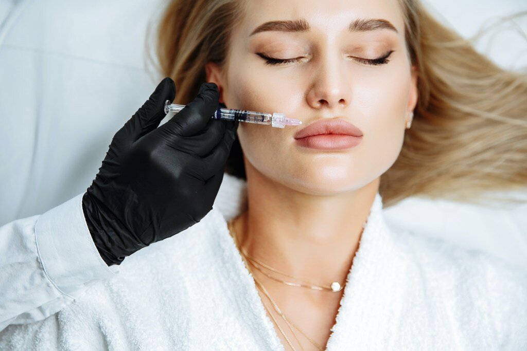 Lip filler procedure