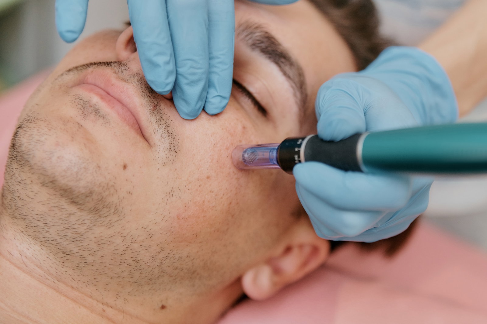 Advanced facial contouring treatment in professional setting