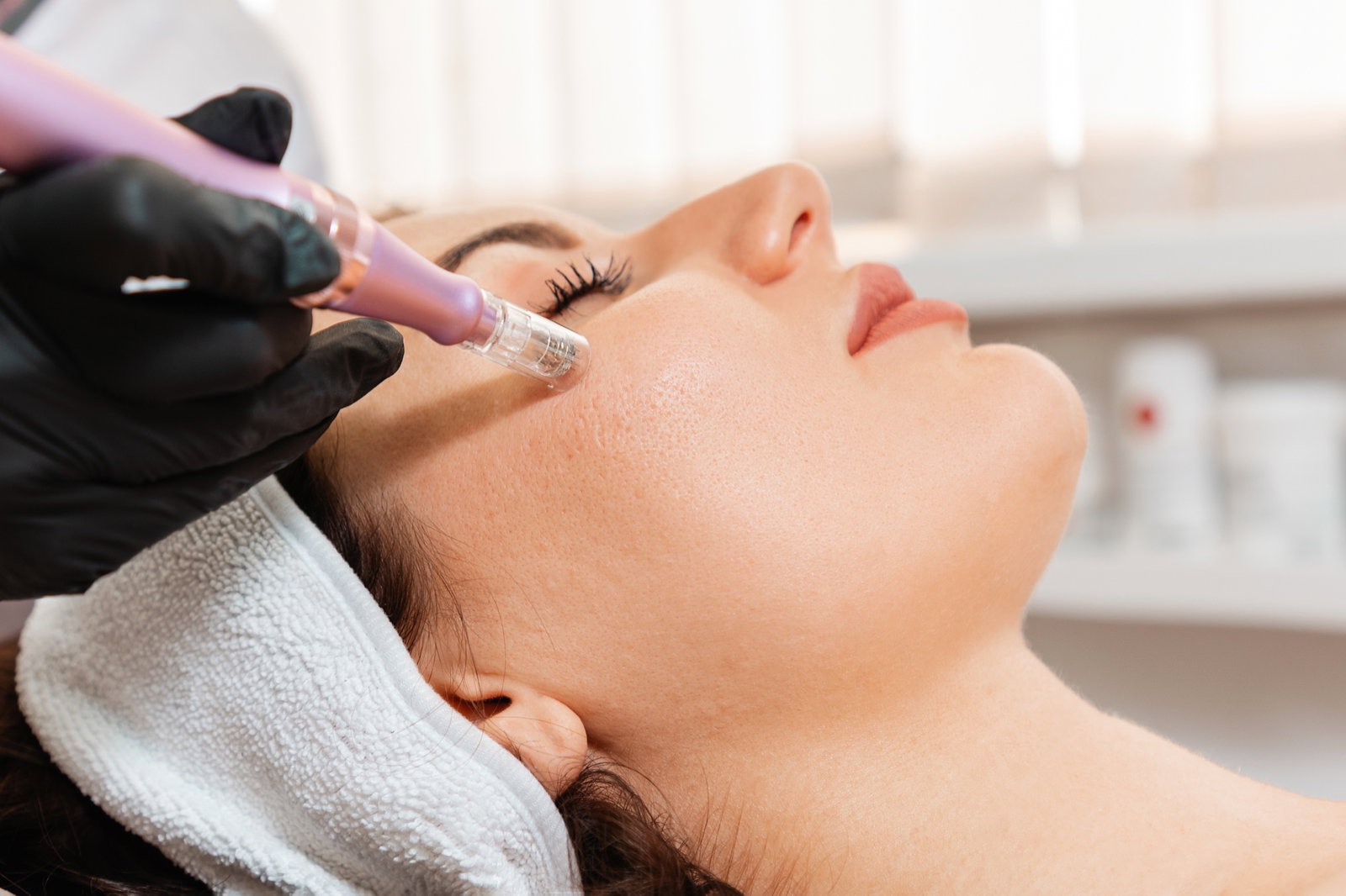 Professional skin resurfacing treatment for texture improvement