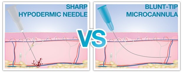 Injection methods comparison