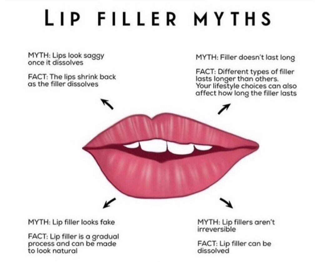 Filler dissolution