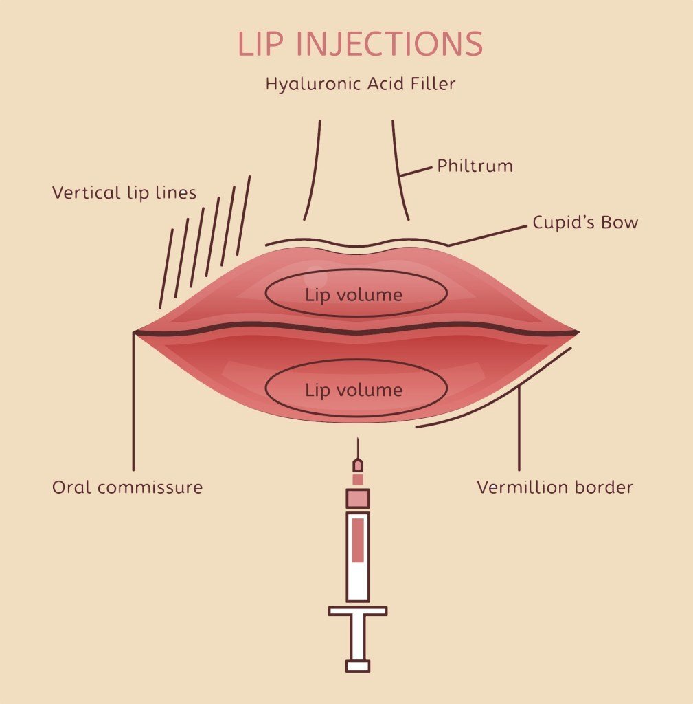 Lips diagram
