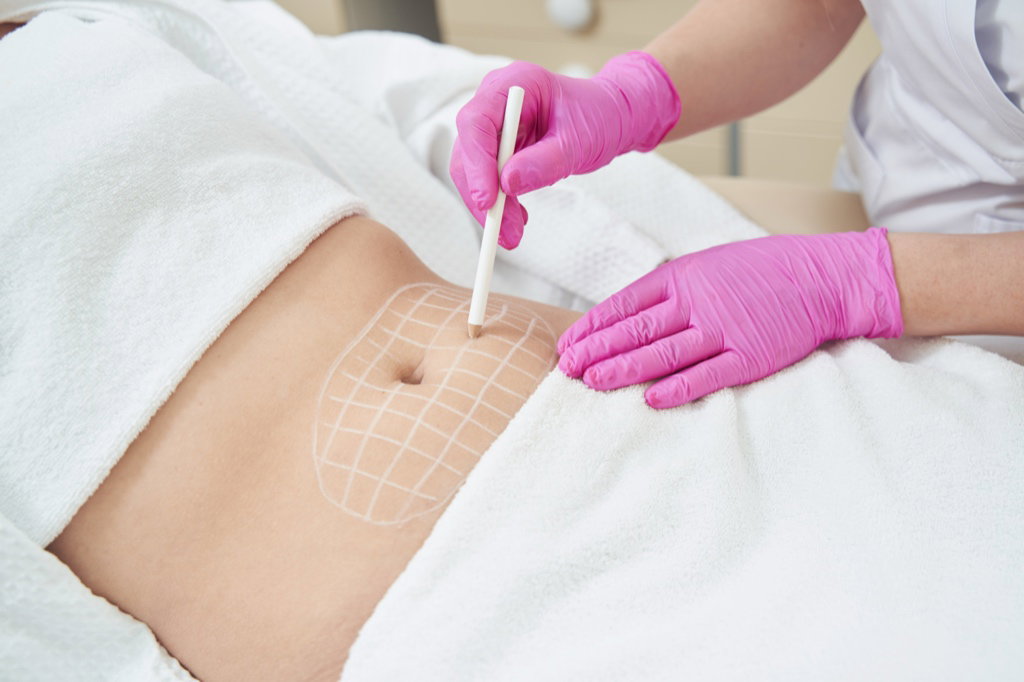 Fat Reduction
